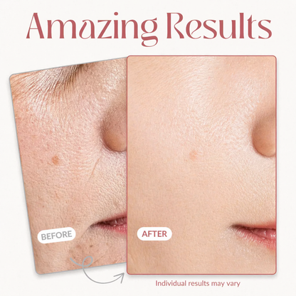 LOVILDS™ Line Smoother Targeted Fine Line Filler Primer