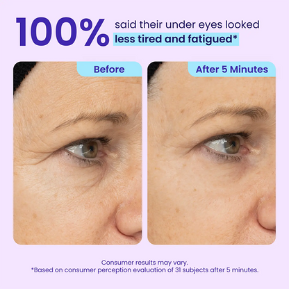 Final 3 Hours: 70%OFF🔥 Instant Eye Tightener Easy