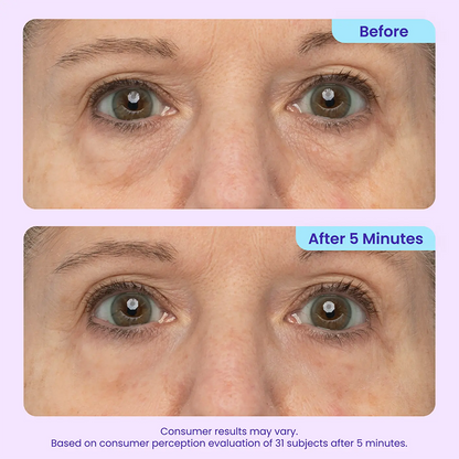 Final 3 Hours: 70%OFF🔥 Instant Eye Tightener Easy