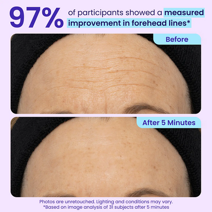 Final 3 Hours: 70%OFF🔥 Instant Eye Tightener Easy