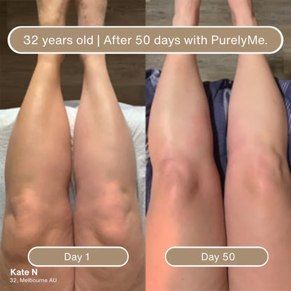 Collagen-Infused Body Oil • Deep Hydration + Firming Feel